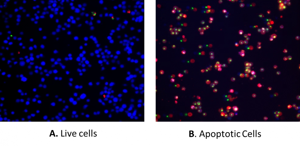 Cell Meter 细胞凋亡和细胞坏死检测试剂盒 三色荧光     货号22843